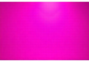 Acupuncture for Weight Loss Works Best With Lifestyle Changes