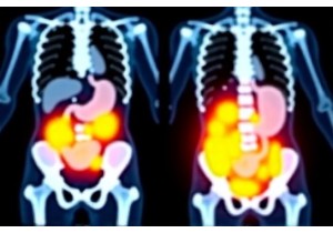 Acupuncture Weight Loss Studies Show Visceral Fat Reduction