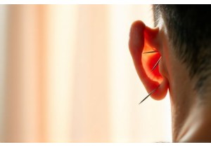 Acupuncture for Weight Loss: Best Practices